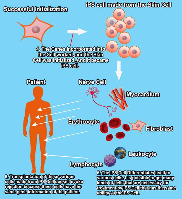 ips cell